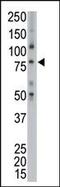 TPX2 Microtubule Nucleation Factor antibody, PA5-11910, Invitrogen Antibodies, Western Blot image 