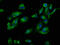 Phosphoinositide-3-Kinase Interacting Protein 1 antibody, LS-C674547, Lifespan Biosciences, Immunofluorescence image 