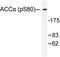 Acetyl-CoA Carboxylase Alpha antibody, LS-C192173, Lifespan Biosciences, Western Blot image 
