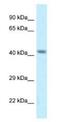 Calcium Voltage-Gated Channel Auxiliary Subunit Gamma 8 antibody, NBP1-82391, Novus Biologicals, Western Blot image 