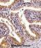 Pleckstrin Homology Like Domain Family A Member 2 antibody, abx028101, Abbexa, Immunohistochemistry paraffin image 