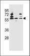 Pyruvate Dehyrogenase Phosphatase Catalytic Subunit 1 antibody, 56-435, ProSci, Western Blot image 