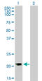 Ras Homolog Family Member A antibody, LS-B6005, Lifespan Biosciences, Western Blot image 