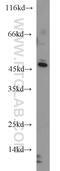 Tyrosyl-TRNA Synthetase 2 antibody, 17150-1-AP, Proteintech Group, Western Blot image 