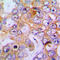 Collagen Type XVIII Alpha 1 Chain antibody, LS-C353586, Lifespan Biosciences, Immunohistochemistry frozen image 