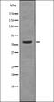 Transforming Growth Factor Beta Receptor 1 antibody, orb336116, Biorbyt, Western Blot image 
