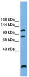 Protein Phosphatase 6 Regulatory Subunit 1 antibody, TA334565, Origene, Western Blot image 