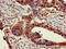 Cholinergic Receptor Nicotinic Beta 1 Subunit antibody, LS-C682166, Lifespan Biosciences, Immunohistochemistry paraffin image 