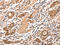 C-C Motif Chemokine Ligand 17 antibody, CSB-PA113746, Cusabio, Immunohistochemistry frozen image 