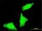 PPP1R2 Family Member B antibody, H00153743-M02, Novus Biologicals, Immunofluorescence image 