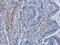 Collagen Type I Alpha 1 Chain antibody, GTX112731, GeneTex, Immunohistochemistry paraffin image 