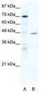 Nuclear Receptor Subfamily 2 Group F Member 6 antibody, TA332066, Origene, Western Blot image 