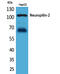 Neuropilin 2 antibody, A02820, Boster Biological Technology, Immunohistochemistry paraffin image 