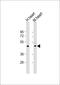 Transmembrane Protein Adipocyte Associated 1 antibody, 61-204, ProSci, Western Blot image 