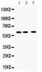 Chaperonin Containing TCP1 Subunit 8 antibody, PB9993, Boster Biological Technology, Western Blot image 