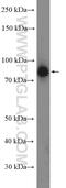 Prolyl 3-Hydroxylase 1 antibody, 26691-1-AP, Proteintech Group, Western Blot image 