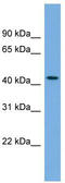 Spindle And Kinetochore Associated Complex Subunit 3 antibody, TA333501, Origene, Western Blot image 