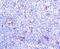 Integrin Subunit Alpha E antibody, NBP2-67663, Novus Biologicals, Immunohistochemistry paraffin image 