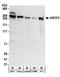 Activating Signal Cointegrator 1 Complex Subunit 3 antibody, A304-014A, Bethyl Labs, Western Blot image 