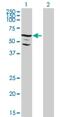 Serine/Threonine Kinase Like Domain Containing 1 antibody, H00169436-B01P, Novus Biologicals, Western Blot image 