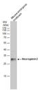 Neurogenin 2 antibody, GTX129258, GeneTex, Western Blot image 