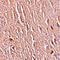 Leucine Rich Repeat Transmembrane Neuronal 3 antibody, orb75563, Biorbyt, Immunohistochemistry paraffin image 