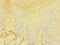 CD226 Molecule antibody, LS-C675483, Lifespan Biosciences, Immunohistochemistry paraffin image 