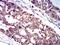Interleukin 9 Receptor antibody, NBP2-61701, Novus Biologicals, Immunohistochemistry frozen image 