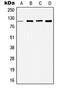 Histone Deacetylase 5 antibody, MBS822337, MyBioSource, Western Blot image 