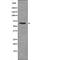 Forkhead Box O4 antibody, PA5-64555, Invitrogen Antibodies, Western Blot image 