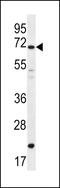 Deleted In Azoospermia 4 antibody, 56-502, ProSci, Western Blot image 