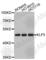 Kruppel Like Factor 5 antibody, A2989, ABclonal Technology, Western Blot image 