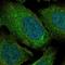 ADAM Metallopeptidase Domain 28 antibody, NBP2-55995, Novus Biologicals, Immunofluorescence image 