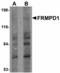 FERM And PDZ Domain Containing 1 antibody, LS-C108611, Lifespan Biosciences, Western Blot image 