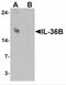 Interleukin 36 Beta antibody, NBP2-41239, Novus Biologicals, Western Blot image 