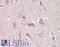 Epsin 2 antibody, LS-B13714, Lifespan Biosciences, Immunohistochemistry paraffin image 