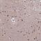 Actin Related Protein 5 antibody, NBP2-14524, Novus Biologicals, Immunohistochemistry frozen image 