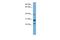 Coiled-Coil Domain Containing 28A antibody, A15599, Boster Biological Technology, Western Blot image 