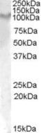 Interleukin 17 Receptor A antibody, PA5-18746, Invitrogen Antibodies, Western Blot image 