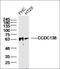 Fibroblast Growth Factor 7 antibody, orb10652, Biorbyt, Western Blot image 