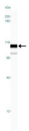 Toll Like Receptor Adaptor Molecule 1 antibody, GTX13810, GeneTex, Western Blot image 