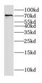 Ecdysoneless Cell Cycle Regulator antibody, FNab02619, FineTest, Western Blot image 