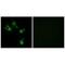 Microtubule Associated Serine/Threonine Kinase Family Member 4 antibody, A11085, Boster Biological Technology, Immunohistochemistry paraffin image 
