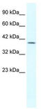 Gastrulation and brain-specific homeobox protein 2 antibody, TA329429, Origene, Western Blot image 