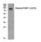 Poly(ADP-Ribose) Polymerase 1 antibody, GTX86935, GeneTex, Western Blot image 
