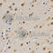 Galectin 3 antibody, A1464, ABclonal Technology, Immunohistochemistry paraffin image 