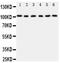 Minichromosome Maintenance Complex Component 2 antibody, GTX12059, GeneTex, Western Blot image 