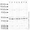 Eukaryotic Translation Initiation Factor 4A2 antibody, ab31218, Abcam, Western Blot image 