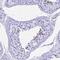 Prostate And Testis Expressed 4 antibody, NBP1-93774, Novus Biologicals, Immunohistochemistry paraffin image 