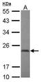 Chromobox protein homolog 2 antibody, GTX117711, GeneTex, Western Blot image 